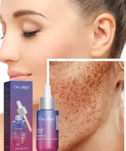 Oveallgo™ Super-B Dark Spot Corrector Serum