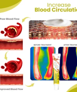 Oveallgo™ SwellAway Leg Comfort Ginger Ointment