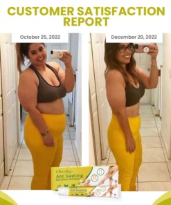 Oveallgo™ SwellAway Leg Comfort Ginger Ointment