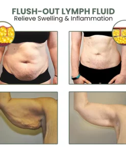 Oveallgo™ Wormwood CelluliteBeGone Skin Tighten Cream