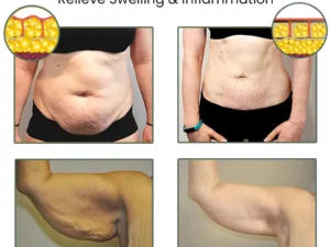 Oveallgo™ Wormwood CelluliteBeGone Skin Tighten Cream