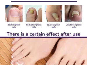 PARONYCHIA REPAIR NAIL ELASTIC CORRECTIVE PATCH