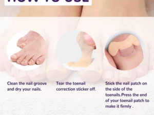 PARONYCHIA REPAIR NAIL ELASTIC CORRECTIVE PATCH