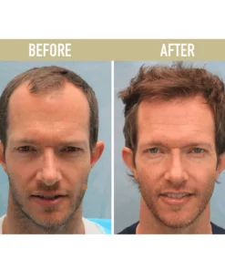 Palms™ Anti-Hair Loss Rice Shampoo Soap