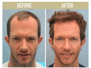 Palms™ Anti-Hair Loss Rice Shampoo Soap