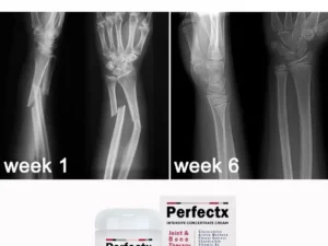 Perfeᴄtx™ Jᴏint & Bᴏne Therapy Cream