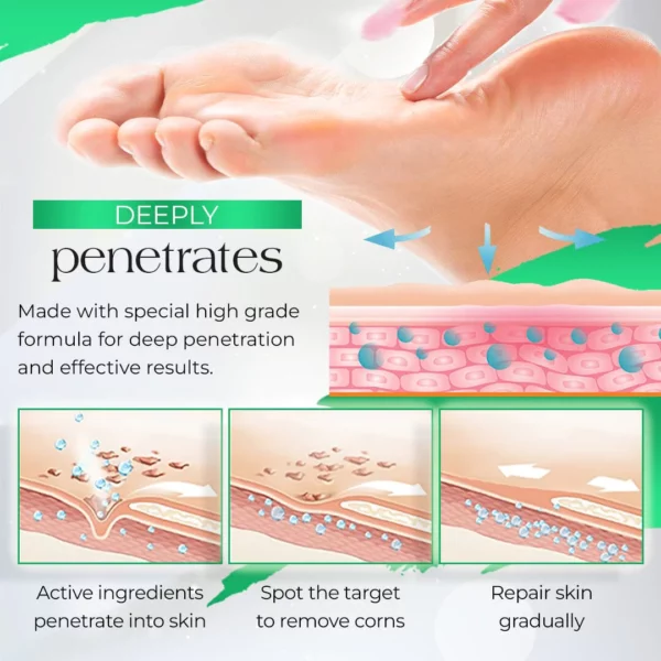 PodiaCorn™ Crema para eliminar los callos en los pies