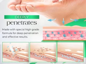 PodiaCorn™ Foot Corn Removal Cream