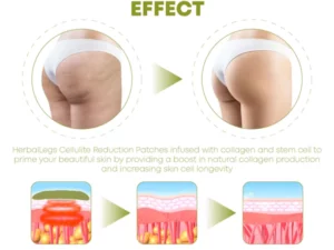 ProHerbal CelluliteReduction LegsFirming Patches