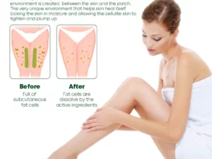 ProHerbal CelluliteReduction LegsFirming Patches