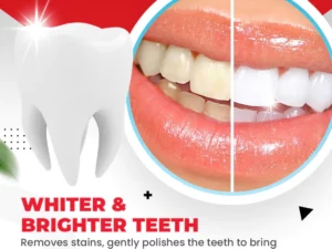 ProbiSmile™Ultra-Whitening Probiotics Polish Toothpaste
