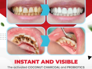 ProbiSmile™Ultra-Whitening Probiotics Polish Toothpaste