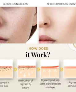 PureBright High-Efficiency Corrective Whitening Spot Cream