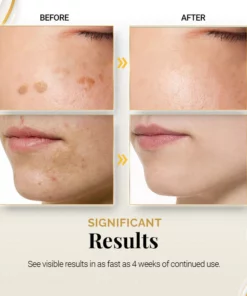 PureBright High-Efficiency Corrective Whitening Spot Cream