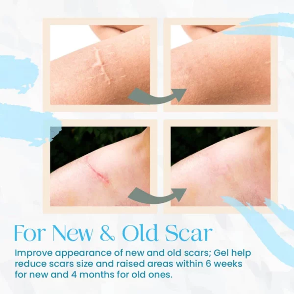 PureFade™ Advance Organic Scar Removing Gel