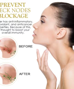 PureHerbal LymphDrainage GingerOil