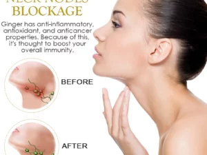 PureHerbal LymphDrainage GingerOil