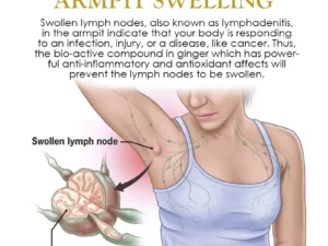 PureHerbal LymphDrainage GingerOil