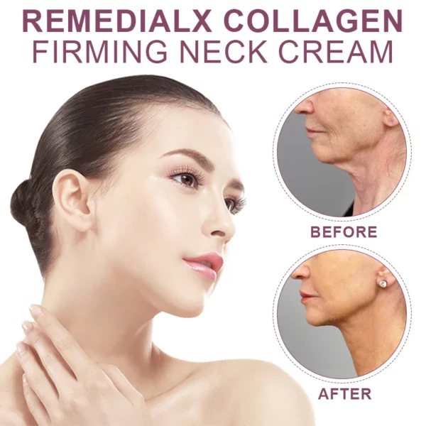 REMEDIALX CollagenCrema reafirmante para el cuello