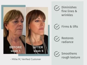 Reborth™ Advanced Collagen Boost Lifting Anti-Aging Serum