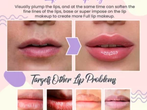 Renew™ Lip Treatment Balm