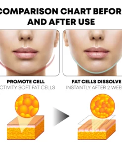 Alternative view of Ricpind Microcurrent VFace FirmingDevice
