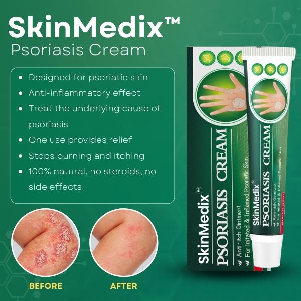 S.Medix™ Psoriasis-Creme