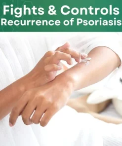S.Medix™ Psoriasis Cream