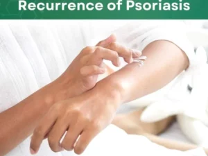 S.Medix™ Psoriasis Cream