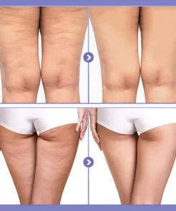SKINNIER Anticellulite & Tightening Thigh Patch