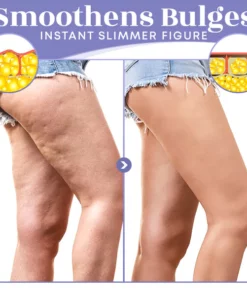 SKINNIER Anticellulite & Tightening Thigh Patch