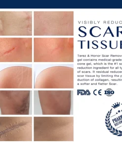 Scar Remover Gel