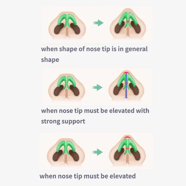 Sci-Effect™ Nose Lift Shaping Oil