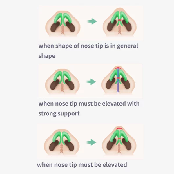 Sci-Effect™ Huile modelante pour le lifting du nez