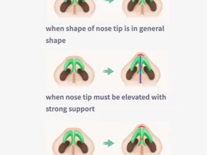 Sci-Effect™ Nose Lift Shaping Oil