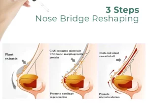 Sci-Effect™ Nose Lift Shaping Oil