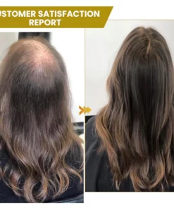 Shouga Hair Growth Powder