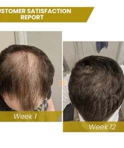 Shouga Hair Growth Powder