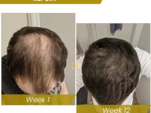 Shouga Hair Growth Powder
