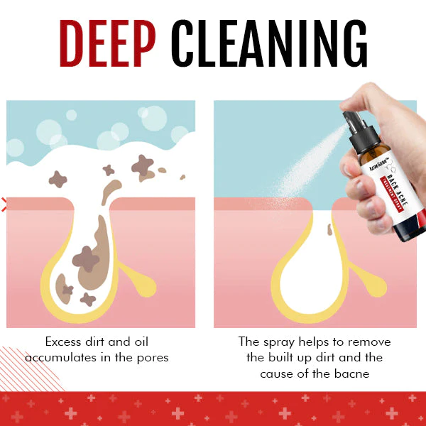 SkinCare™ Spray para o tratamento do acne nas costas