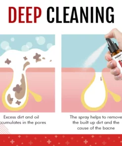 SkinCare™ Back Acne Treatment Spray