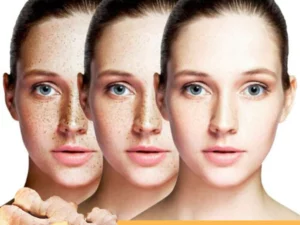 Skinetic™ Spot-Off Turmeric Oil