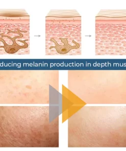 Skinetic™ Spot-Off Turmeric Oil