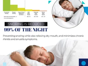 SleepFlex™Anti Snore Acupressure Ring