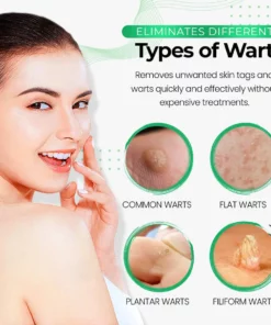 SmoothSkin Wart Eliminator Soap