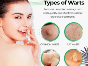 SmoothSkin Wart Eliminator Soap