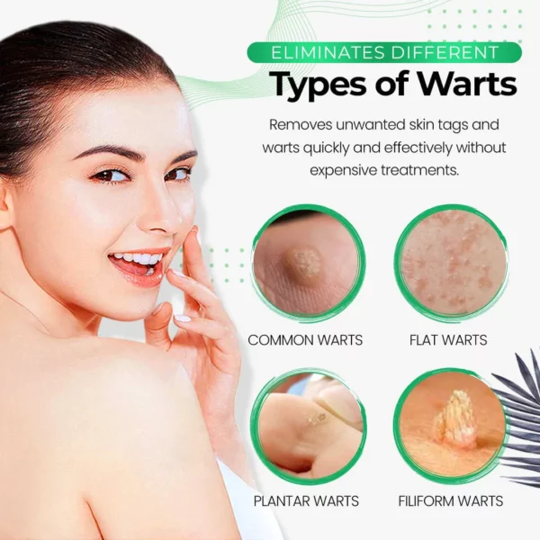 Xabón eliminador de verrugas SmoothSkin