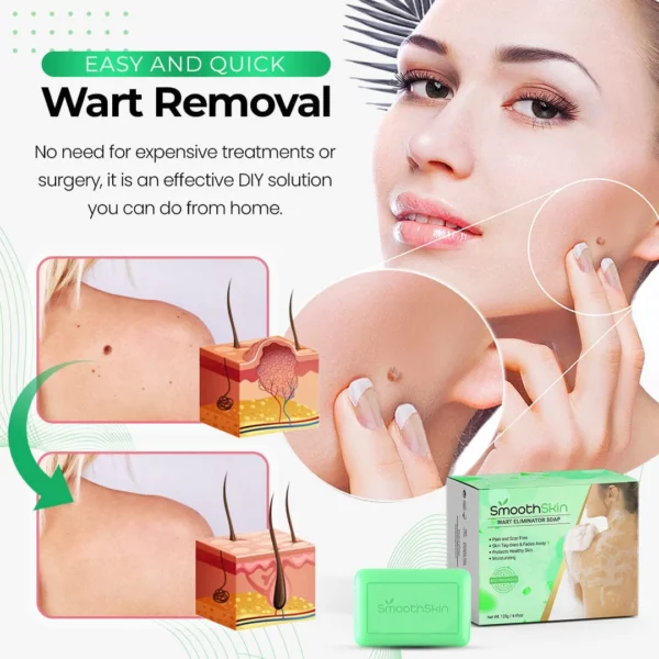 Xabón eliminador de verrugas SmoothSkin