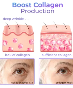 Soluble Collagen Thread & Nano Platinum Essence Gesichtsstraffungsset