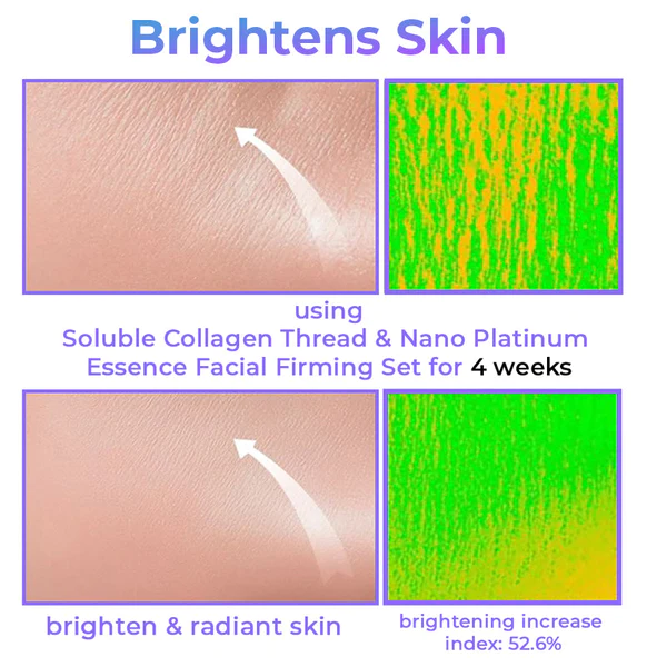 Hilo de colágeno soluble y esencia de nanoplatino Gesichtsstraffungsset